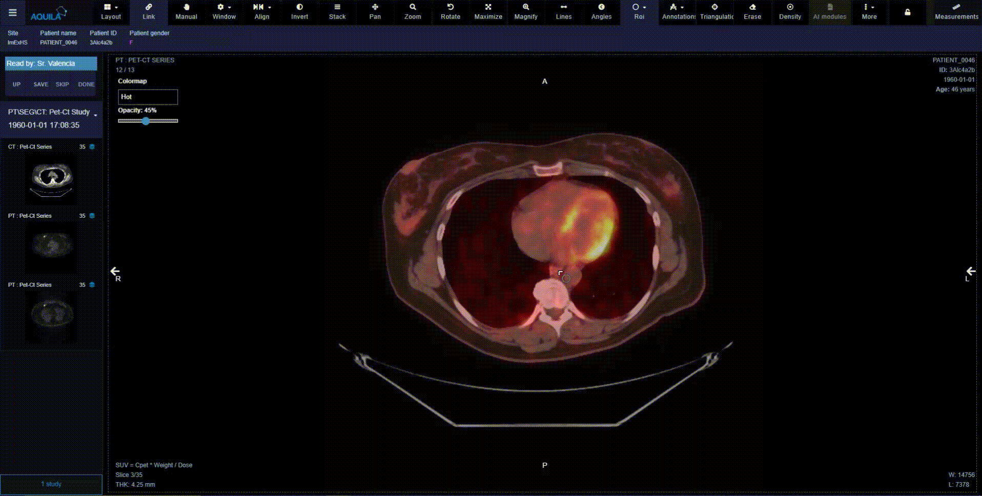 VISOR-AQUILA-editado